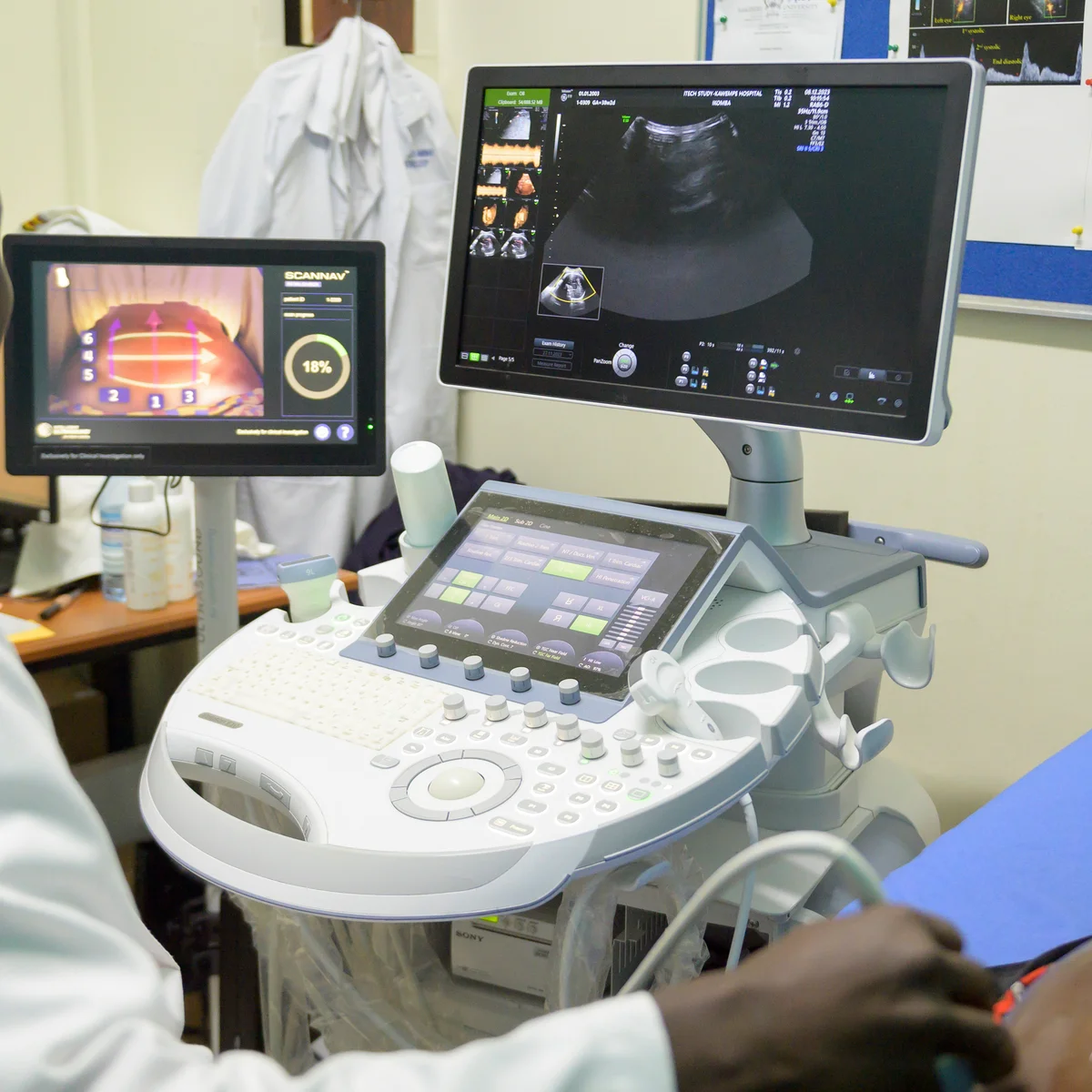 Obstetric Ultrasound