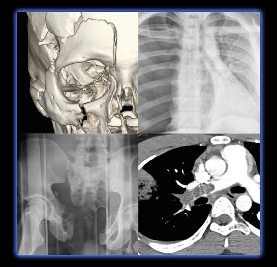 Emergency Imaging